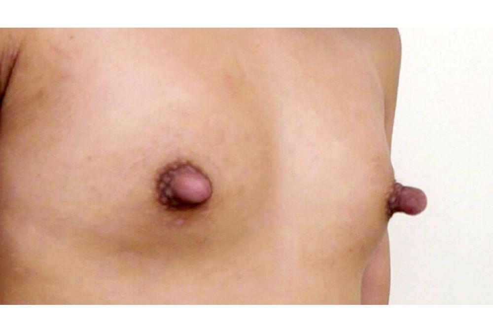 KTKL-141 Girls With Overly Sensitive, Complex-ridden Nipples That Stick Out Unusually Long. 4 Hours Screenshot 1