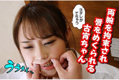RMER-003 Orthodontic Woman Hasegawa Koyoi Screenshot